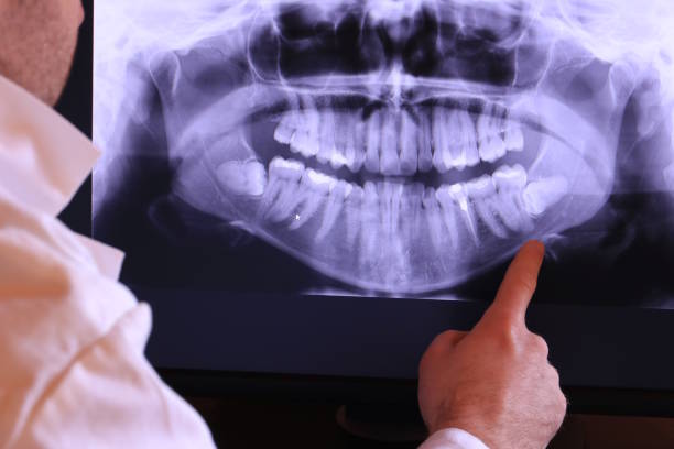 Best Emergency Broken Tooth Repair in Blountville, TN